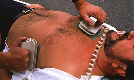 Defibrillation instance